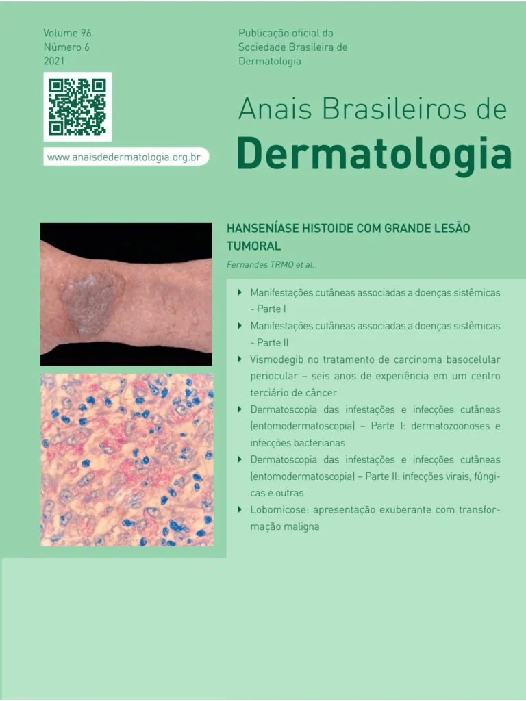 Capa - Anais Brasileiros de Dermatologia